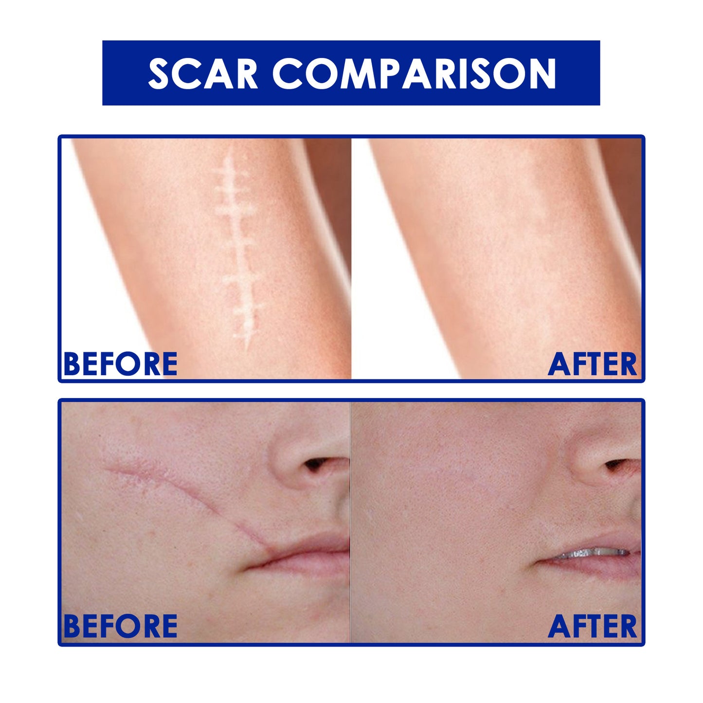 Skin Care Gel for Wound and Scar Repair